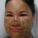 Bethany no hospital - foto Emanuel Medical Center - G1 -ADF